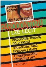 Parodontózu lze léčit od Franz Steiwandtner